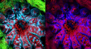 Confocal Microscope Turns Science into Art